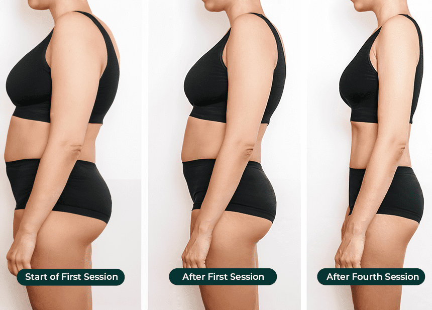 weight with body sculpting treatment