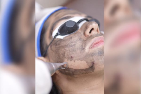 Haror treatments_carbon facial