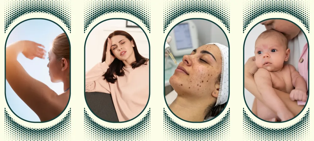 best skin treatment in delhi