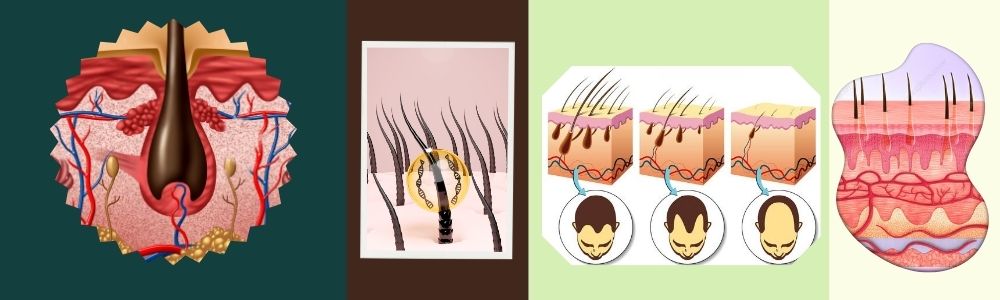 mesotherapy for hair