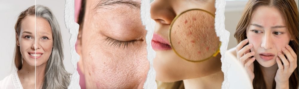 effects of air pollution on the skin
