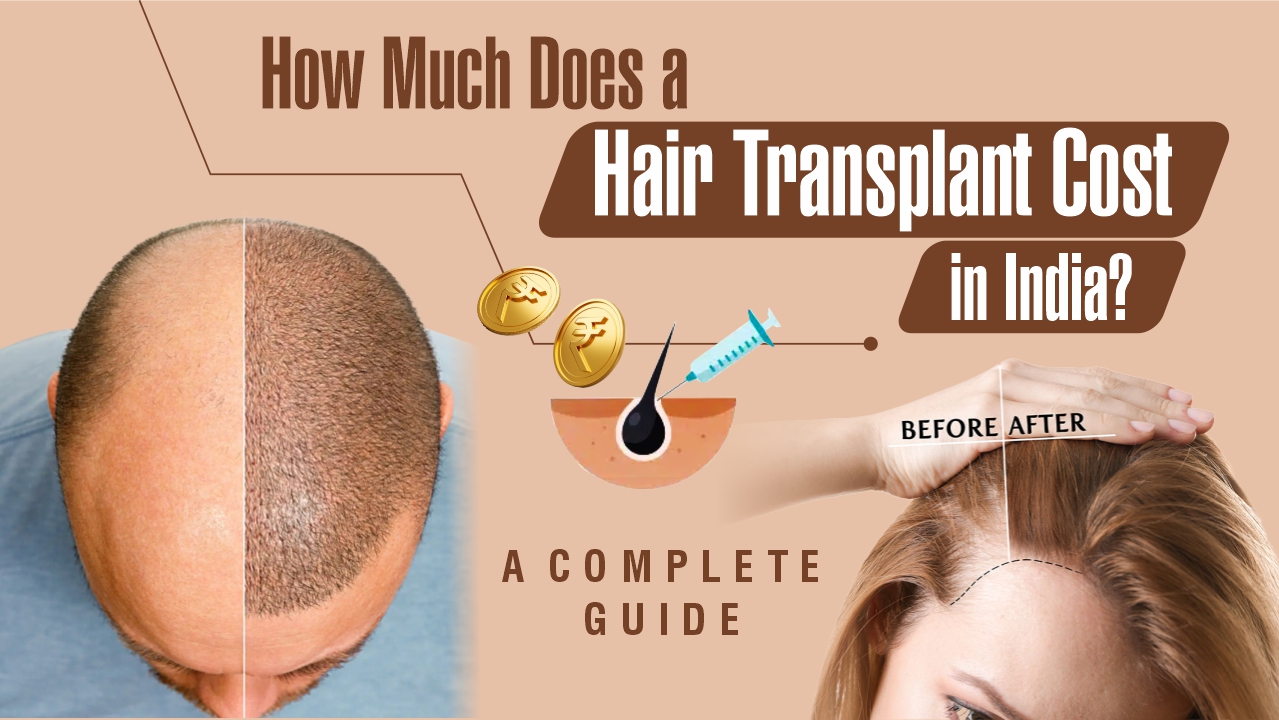 Hair-Transplant-Cost-In-Delhi-India
